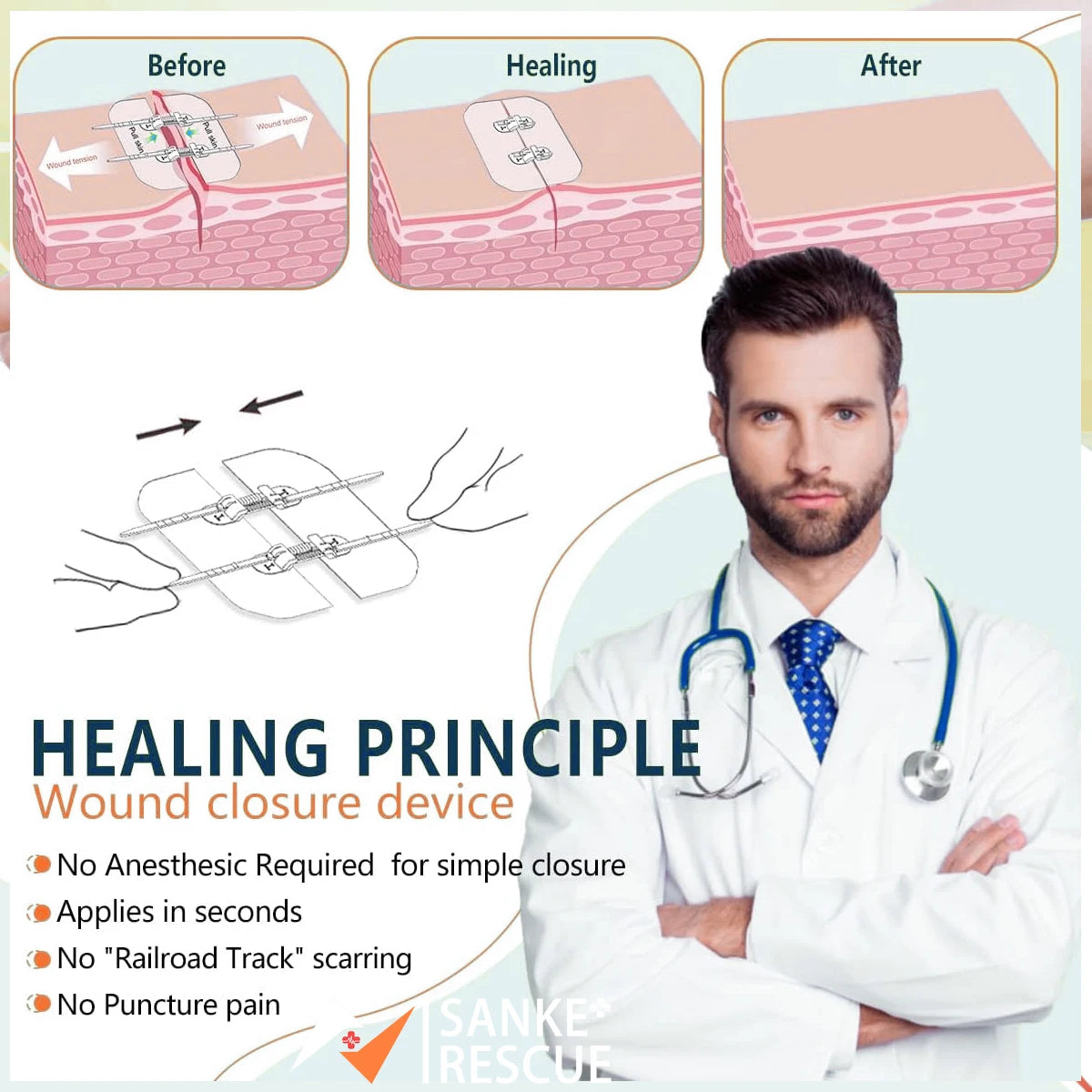 Zipper Pacemaker Closure Device 2-4PCS Zipper Painless Wound Closure Device Suture-free Wound Dressing ...